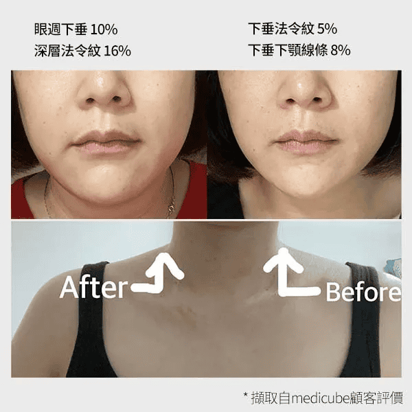 luminage FACE LASER Smoothing Light NEW