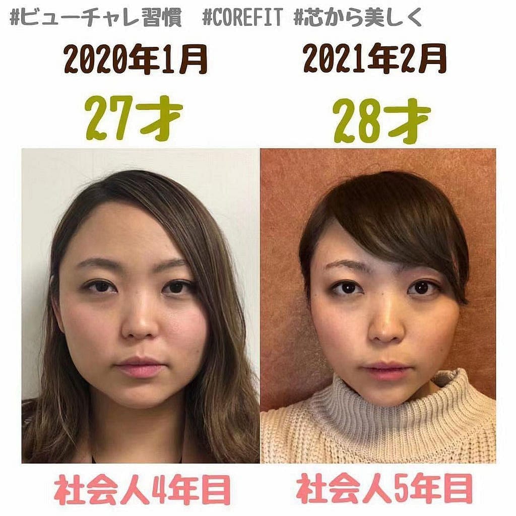 Estnation Corefit Face player EMS瘦面美容儀 套裝