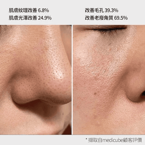 Medicube AGE-R ATS 緊緻收斂毛孔