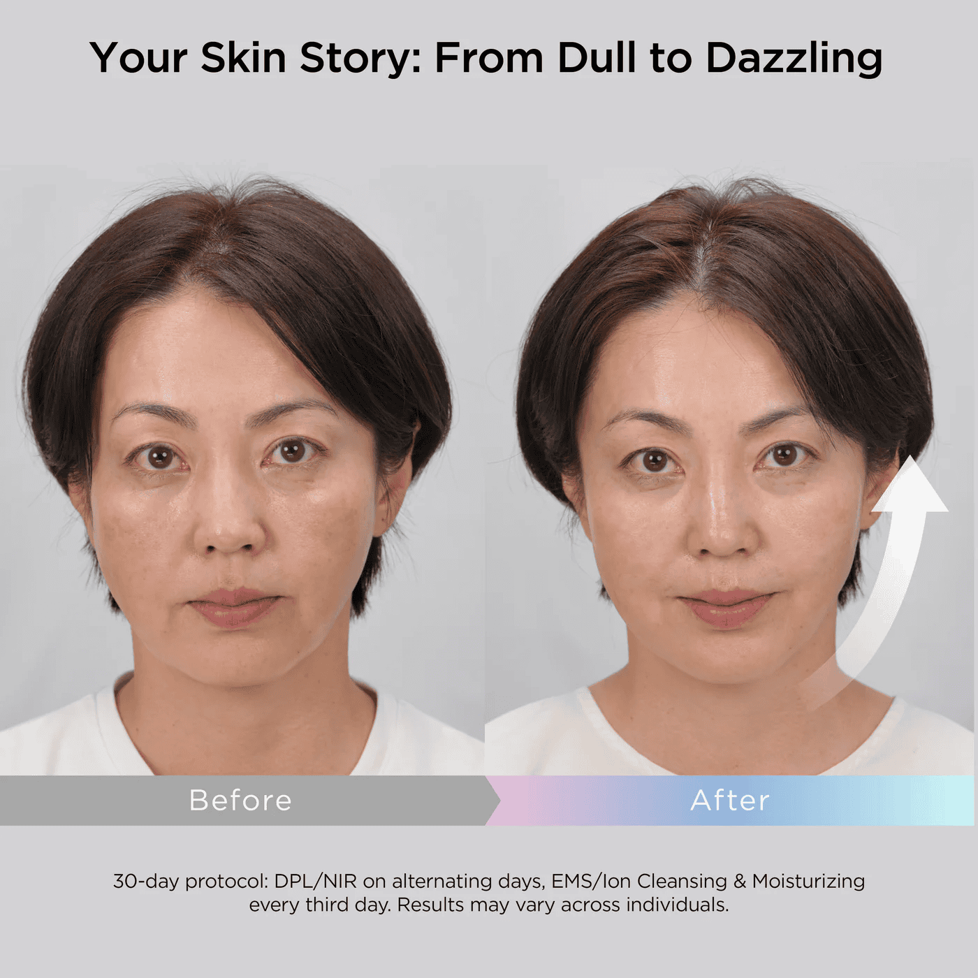 Mytrex MiRAY ONE   五合一美容儀